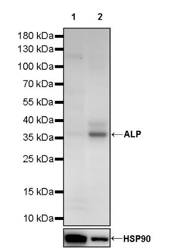 ALP Recombinant Rabbit mAb (S-2786-41)
