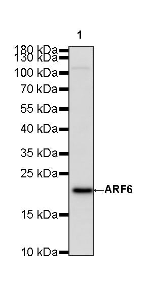 ARF6 Recombinant Rabbit mAb (S-4283-62)