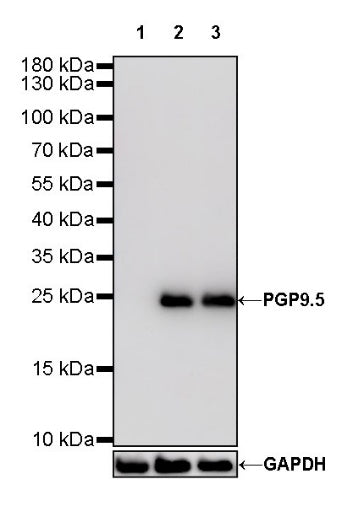 PGP9.5 Recombinant Rabbit mAb (S-R281)