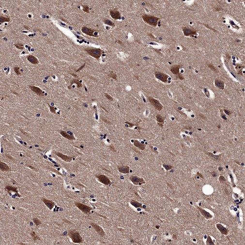 5HT1A Receptor Rabbit Polyclonal Antibody