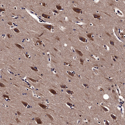 5HT1A Receptor Rabbit Polyclonal Antibody