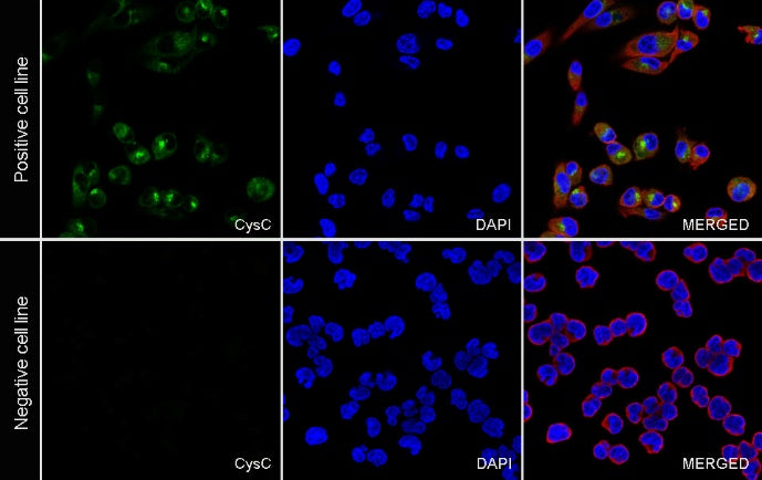 CysC Recombinant Rabbit mAb (S-1658-86)