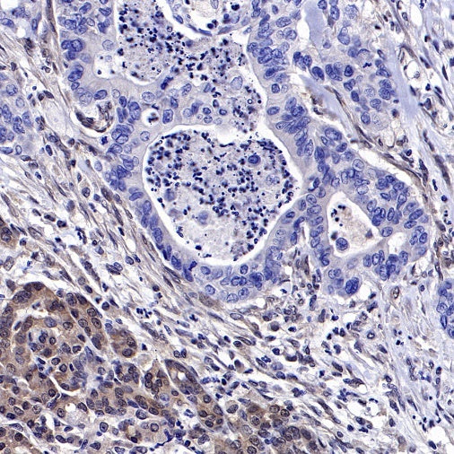 SMAD4 Recombinant Rabbit mAb (SDT-168-62)