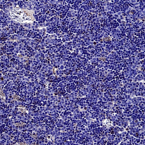 Cleaved Caspase-3 (Asp175) Recombinant Rabbit mAb (S-2817)