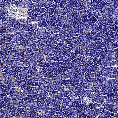 Cleaved Caspase-3 (Asp175) Recombinant Rabbit mAb (S-2817)