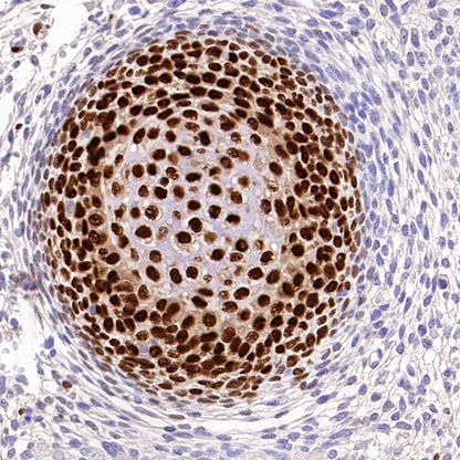 Sp7/Osterix Recombinant Rabbit mAb, PBS Only  (SDT-3238-16)