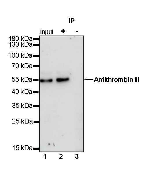 Antithrombin III Recombinant Rabbit mAb (SDT-294-211)