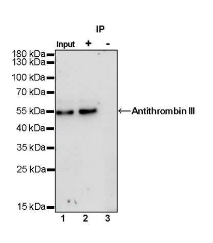 Antithrombin III Recombinant Rabbit mAb (SDT-294-211)