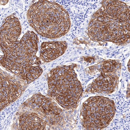 TRIM29 Recombinant Rabbit mAb (S-642-43)