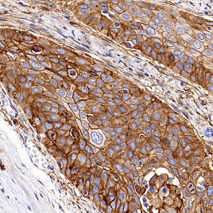 MARCKS Recombinant Rabbit mAb (S-3190-72)