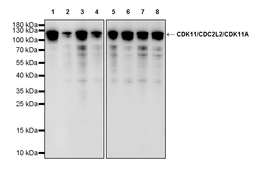 CDK11/CDC2L2/CDK11A Recombinant Rabbit mAb (S-3994-75)