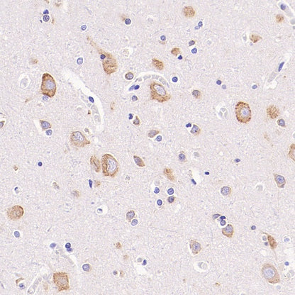 FXR1 Rabbit Polyclonal Antibody