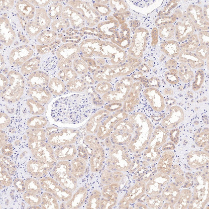 AMPKα Recombinant Rabbit mAb (S-784-68)