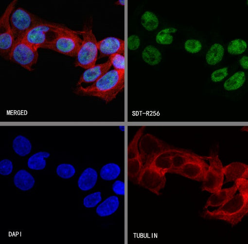 O-Linked N-Acetylglucosamine Rabbit mAb (S-R256)