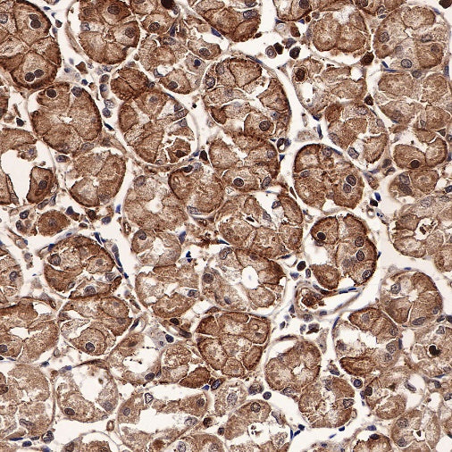 ST13 Recombinant Rabbit mAb (S-661-38)