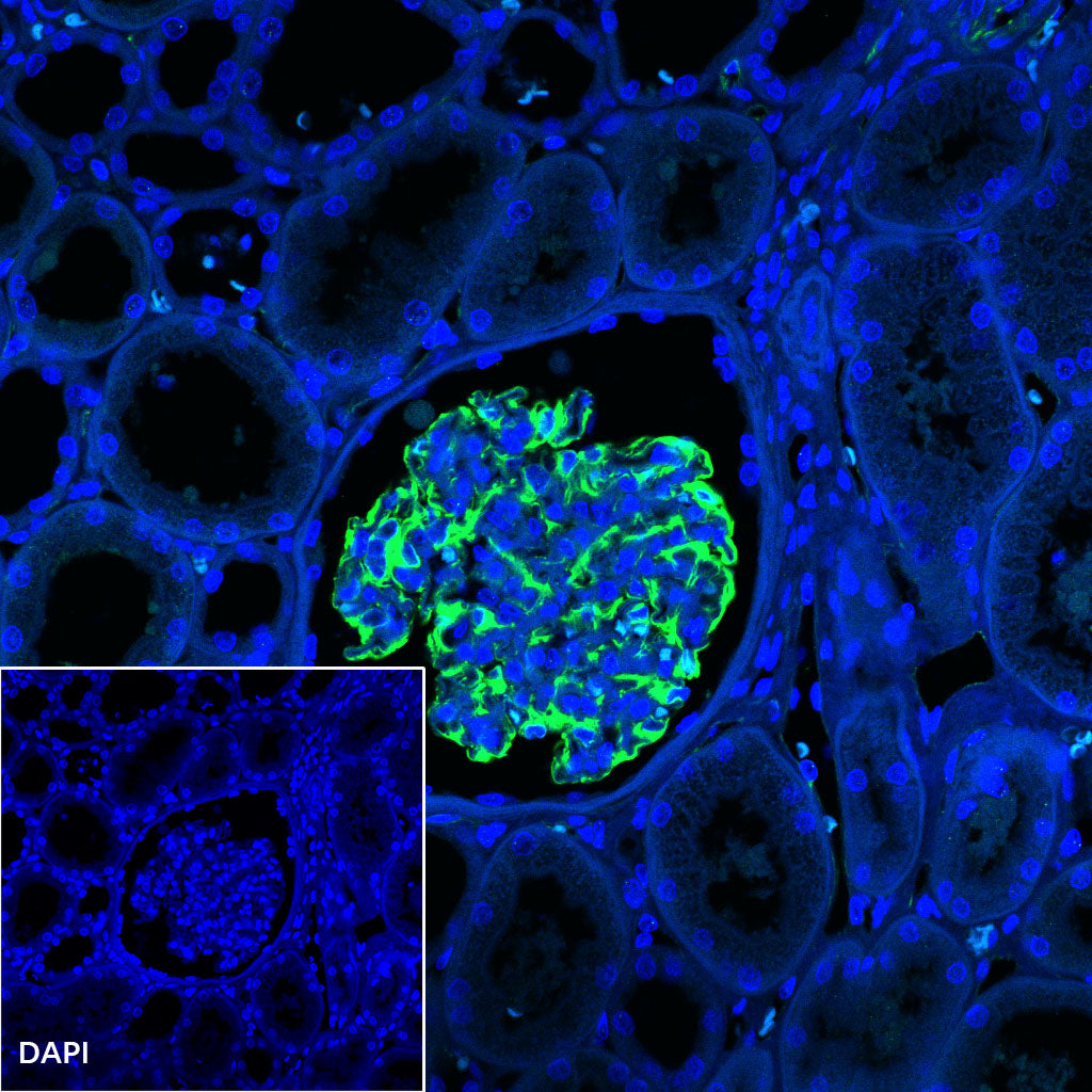 Nestin Recombinant Rabbit mAb (SDT-R112)