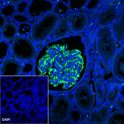 Nestin Recombinant Rabbit mAb (SDT-R112)