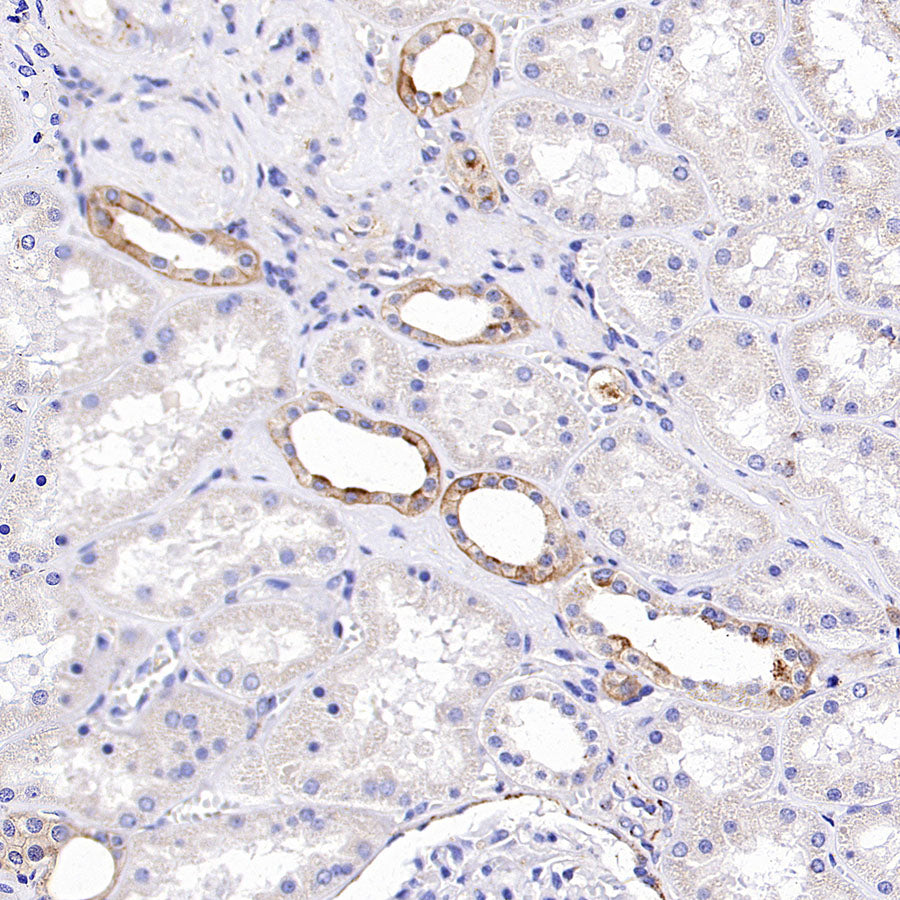 Niemann Pick C1 Recombinant Rabbit mAb (S-5243)