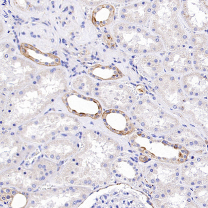 Niemann Pick C1 Recombinant Rabbit mAb (S-5243)