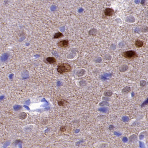 Phospho-α-Synuclein (Ser129) Recombinant Rabbit mAb, PBS Only  (SDT-3397)