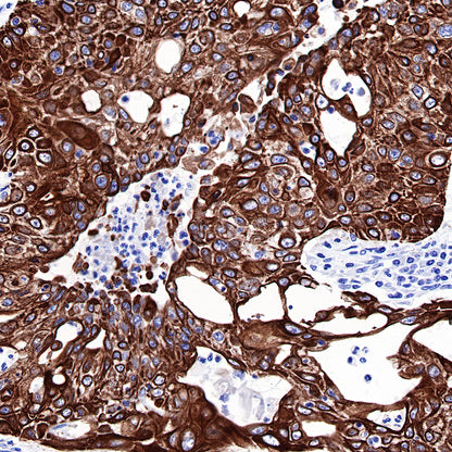 S-RMab® CK-Pan Recombinant Rabbit mAb,PBS Only (SDT-P001)
