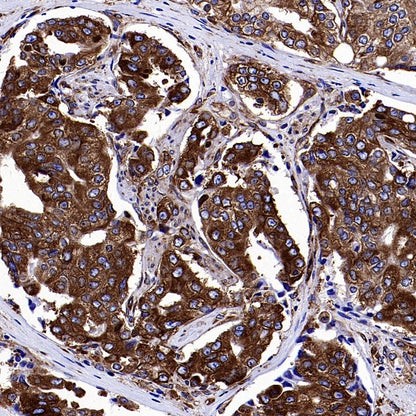 YB1 Recombinant Rabbit mAb (S-1748-144)