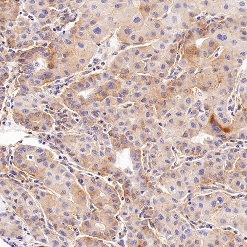 ATG9A Recombinant Rabbit mAb (S-1418-5)