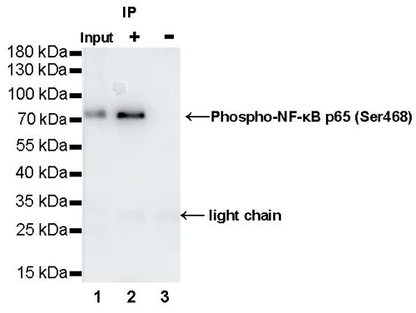 Phospho-NF-κB p65 (Ser468) Recombinant Rabbit mAb (S-1124-133)