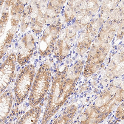eIF5A Rabbit Polyclonal Antibody