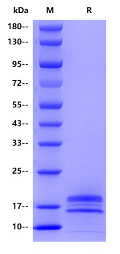 papillomavirus type 16 E7 His Tag Protein, Human