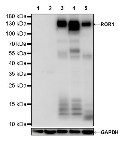 ROR1 Recombinant Rabbit mAb,PBS Only (SDT-R501-148)