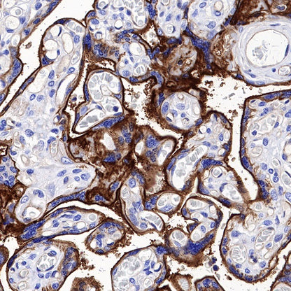 Integrin alpha 5 Recombinant Rabbit mAb (S-381-37)