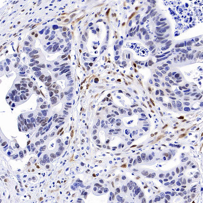 FoxO1 Recombinant Rabbit mAb (S-5118)
