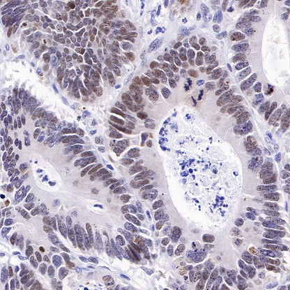 APE Recombinant Rabbit mAb (S-R349)