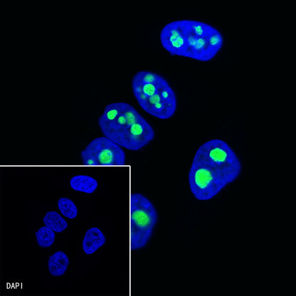 Nucleophosmin/NPM Recombinant Rabbit mAb (S-R231)
