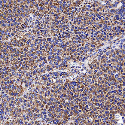 CLPP Recombinant Rabbit mAb (S-4169-31)