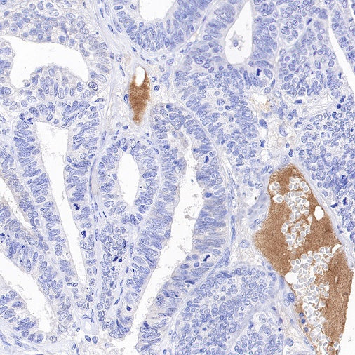 Transferrin Recombinant Rabbit mAb (S-1611-43)