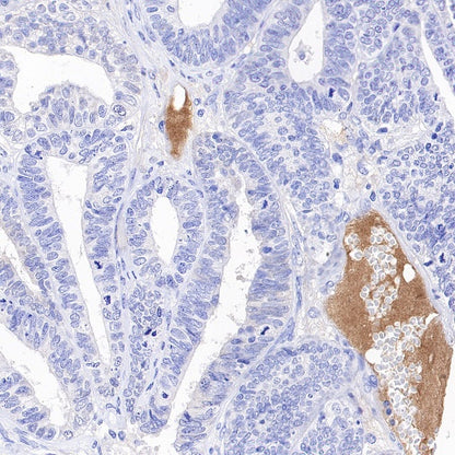 Transferrin Recombinant Rabbit mAb (S-1611-43)