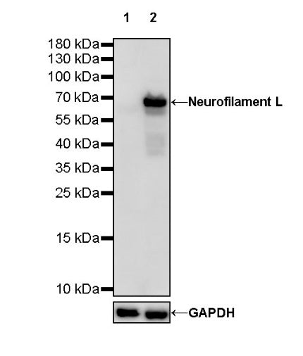 Neurofilament L Recombinant Rabbit mAb (S-635-214)
