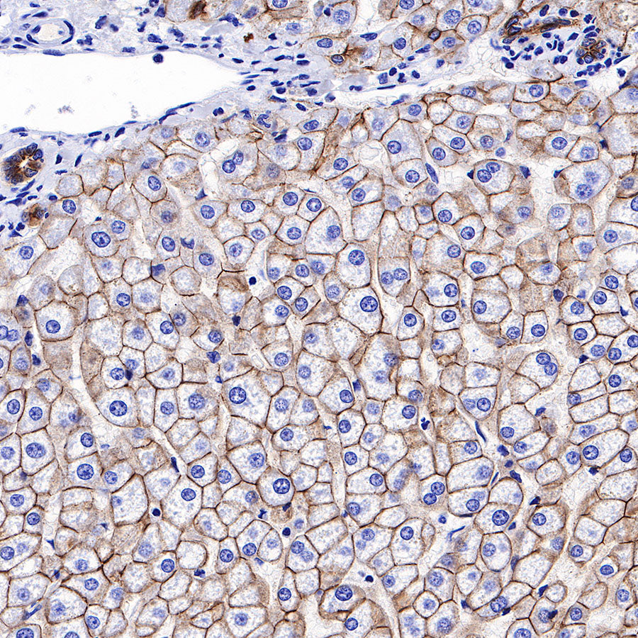 S-RMab® E-Cadherin Recombinant Rabbit mAb (SDT-R088)