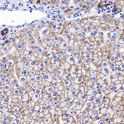 S-RMab® E-Cadherin Recombinant Rabbit mAb (SDT-R088)
