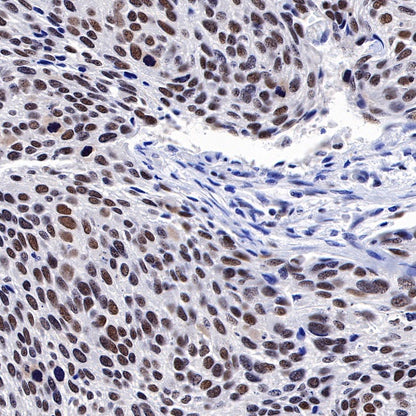 PARP1 Recombinant Rabbit mAb (S-220-179)