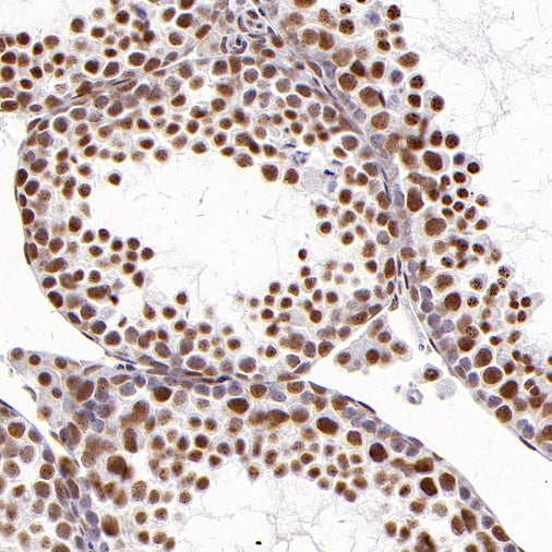 TEL1 Recombinant Rabbit mAb (S-3067-60)