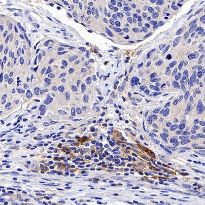 PD-L2 Recombinant Rabbit mAb (S-1041-21)