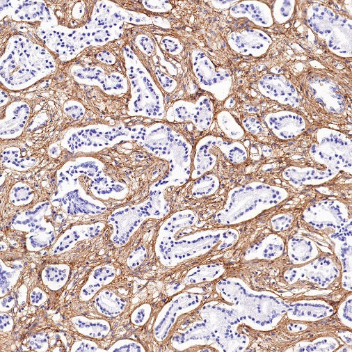 Collagen VI (COL6A1) Recombinant Rabbit mAb (S-1495-18)