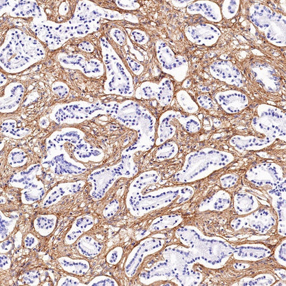 Collagen VI (COL6A1) Recombinant Rabbit mAb (S-1495-18)