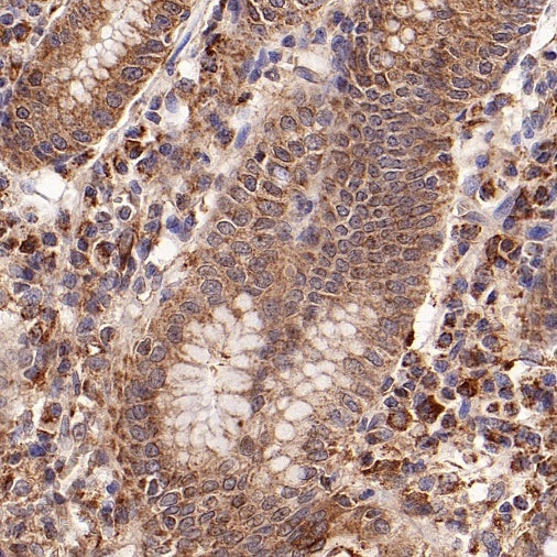 SMAD2 Rabbit Polyclonal Antibody