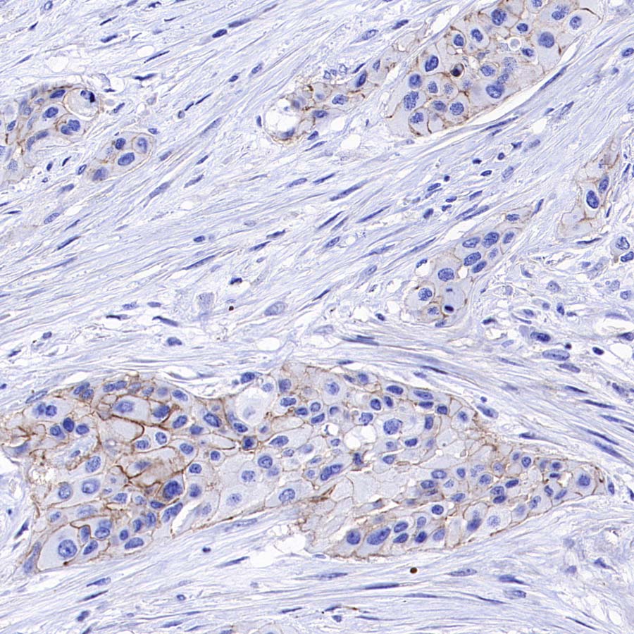 ABCC1/MRP1 Recombinant Rabbit mAb (SDT-4056-11)
