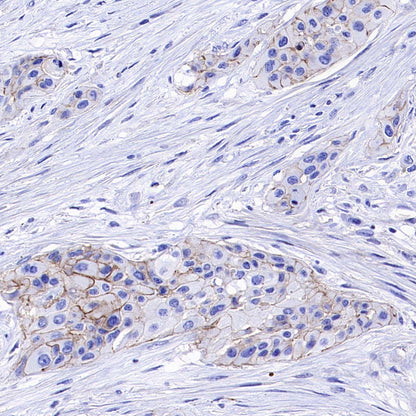 ABCC1/MRP1 Recombinant Rabbit mAb (SDT-4056-11)