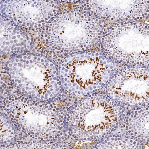 Histone H4 (acetyl K5) Recombinant Rabbit mAb (S-1464-112)